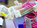 چاپ سه بعدی و اهدای امکان حرکت بازوها به دختر خردسال | نارنجی