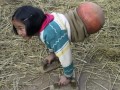دختر معلولی که برای راه رفتن از توپ بسکتبال استفاده می‌کند - روژان